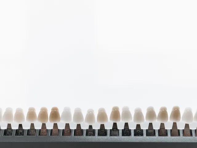 Zahnfarbring mit Keramik-Musterzähnen in verschiedenen Farbtönen zur Auswahl der passenden Veneer-Farbe.