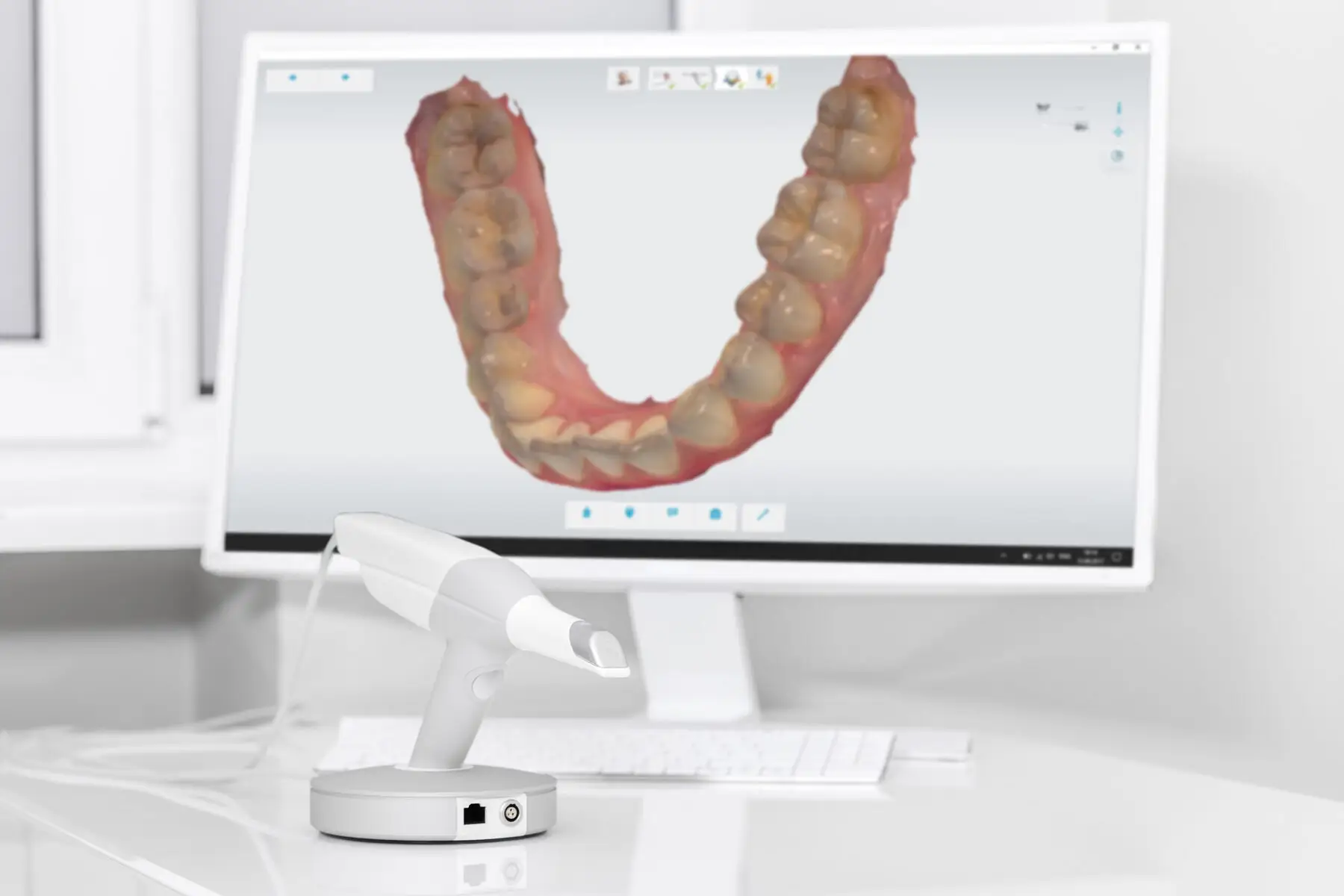 Digitaler Intraoralscan eines Kiefers auf dem Monitor.